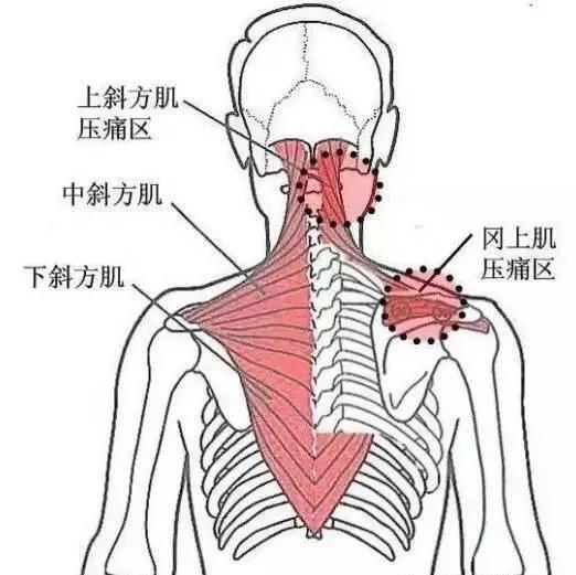 潮湿,风寒,劳累,扭伤等可使症状加重;患处肌肉僵硬,压之酸痛或触及索